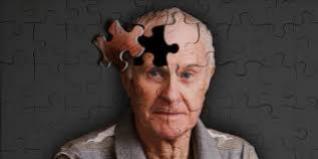 Alzheimer precoce: diagnstico e tratamento