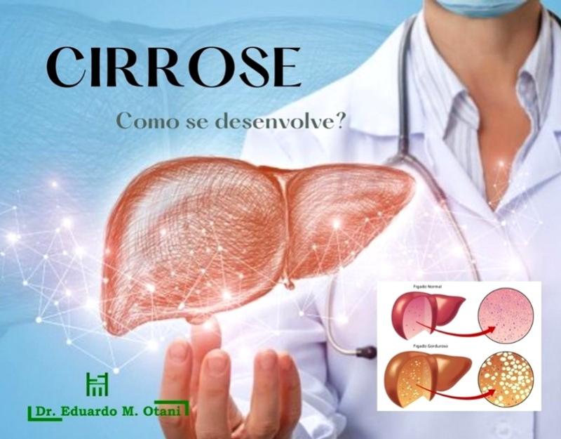 Dr. Eduardo M. Otani - Cirrose, uma doença que se desenvolve lentamente