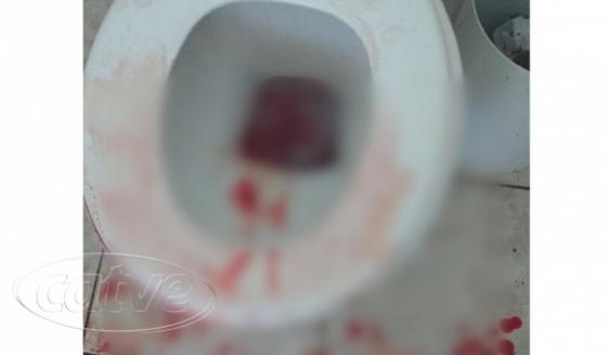 Apucarana: Garota de 15 anos faz aborto de trigmeos no banheiro do colgio
